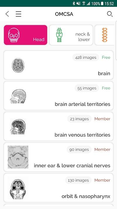 omcsa医学app下载,omcsa,医学app,ct影像app