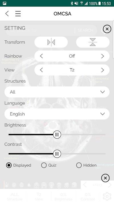 omcsa医学app下载,omcsa,医学app,ct影像app